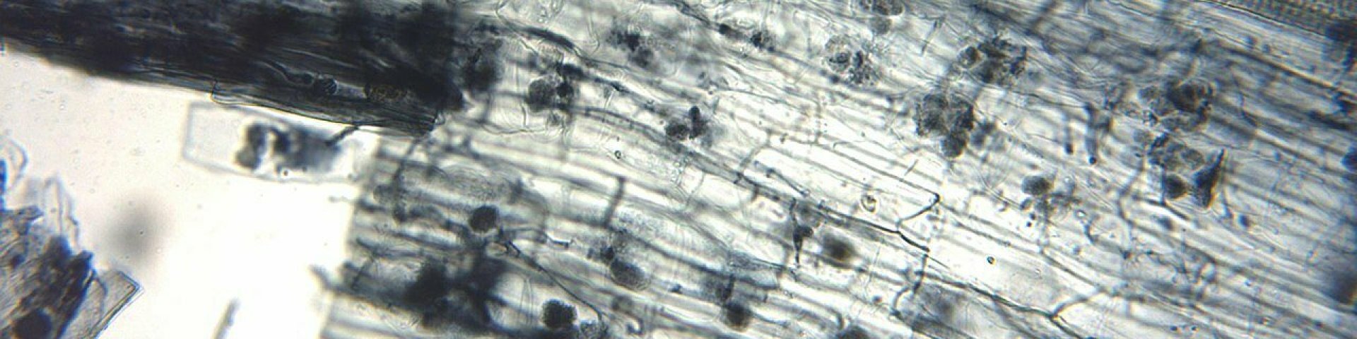 Arbuskulaarne mükoriisa mikroskoobist vaadatuna